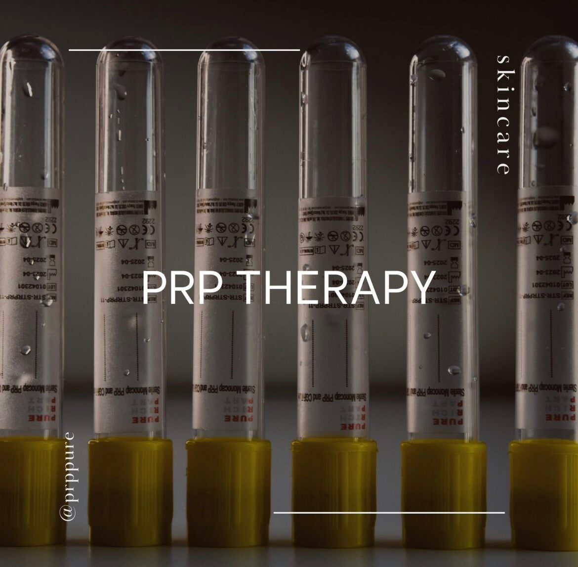 PRP Hair Restoration Course of 6 Sessions