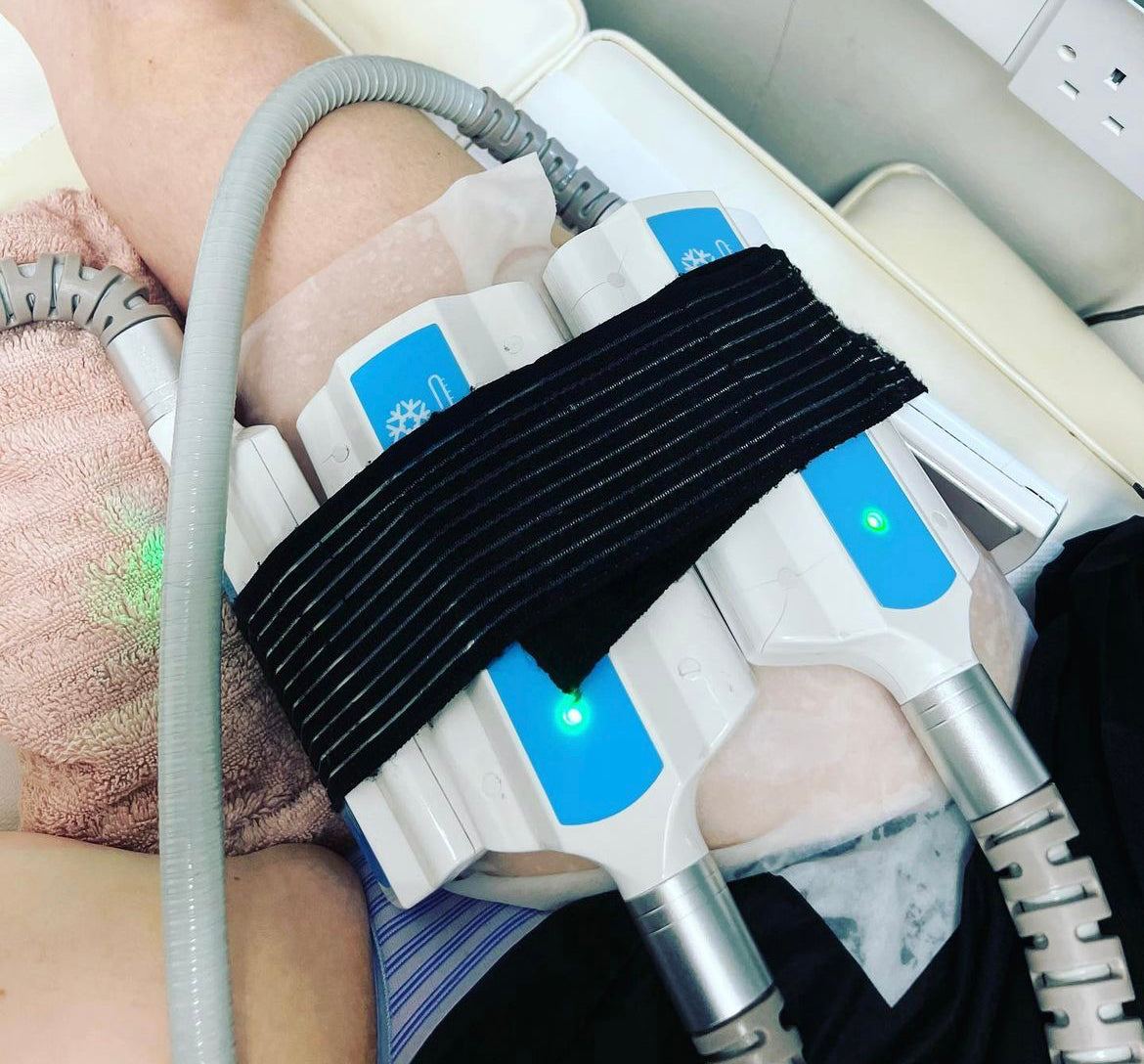 Standard Fat Freezing Four Areas