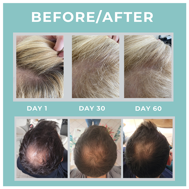 Cebelia Anti-Hair Loss Lotion