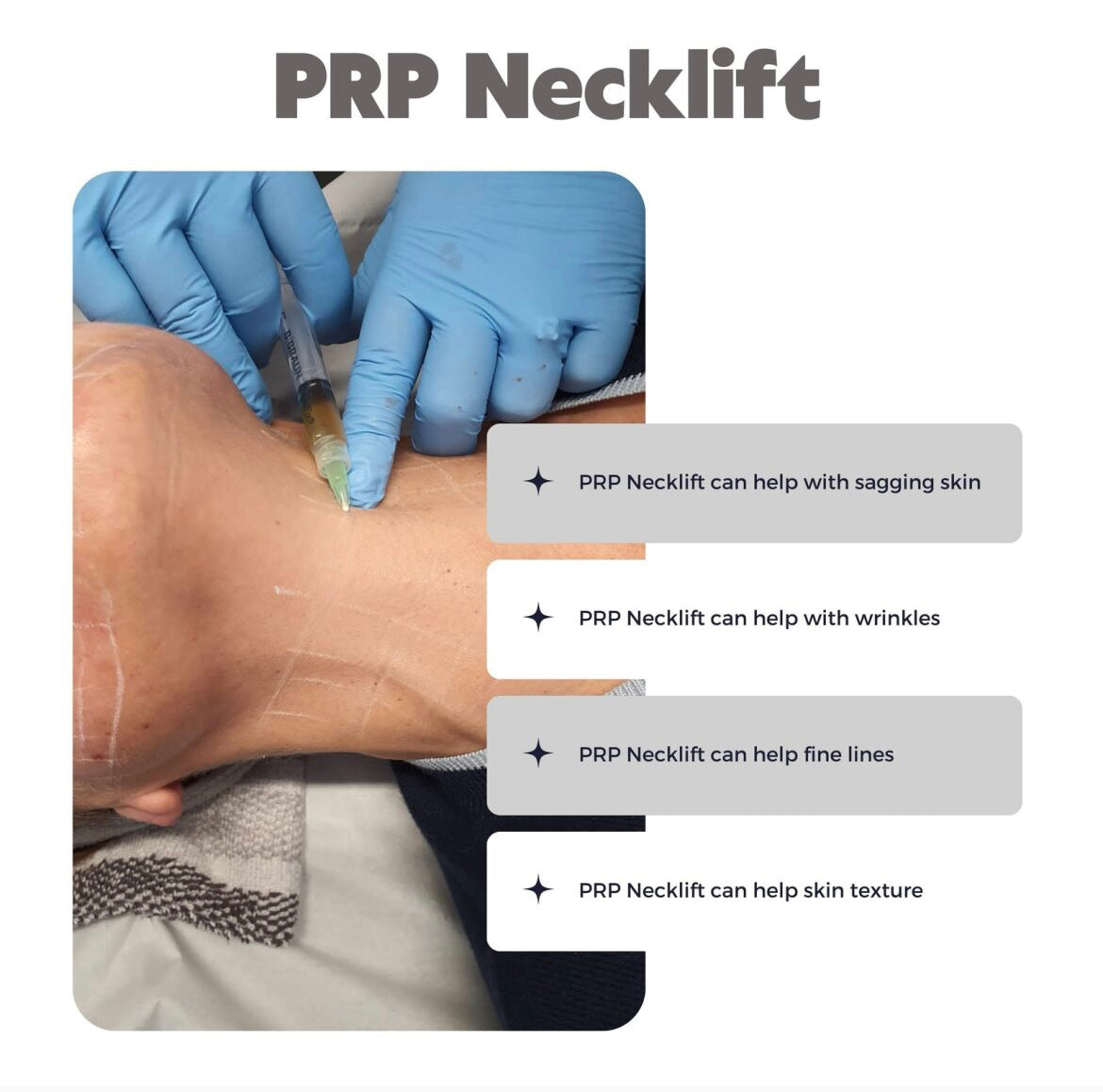 PRP Neck Rejuvenation Single Session