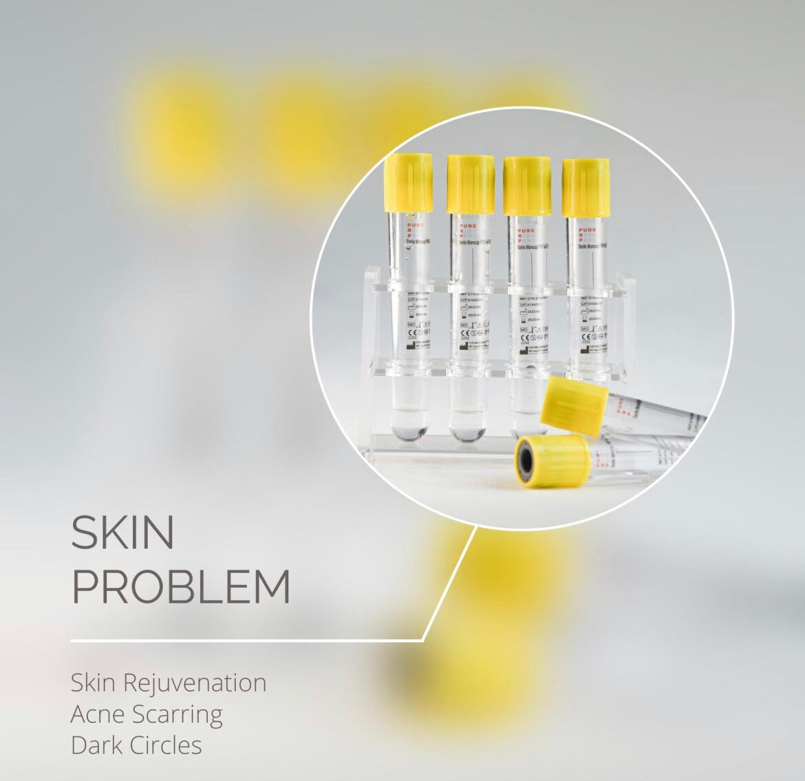 PRP Full face skin rejuvenation course of 3 sessions