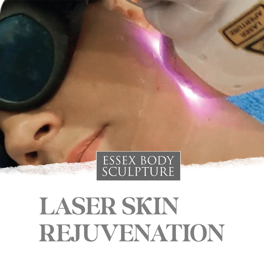 Laser Skin Rejuvenation Course of 5 sessions